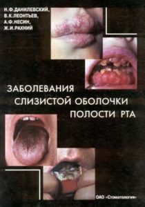 Скачать Заболевания слизистой оболочки полости рта - Данилевский