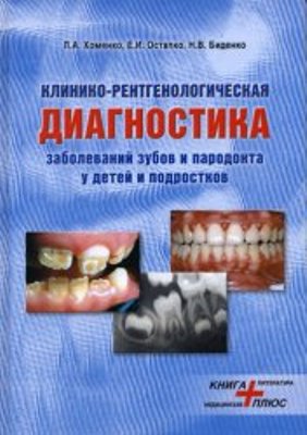 Скачать Клинико-рентгенологическая диагностика заболеваний зубов и пародонта у детей и подростков - Хоменко