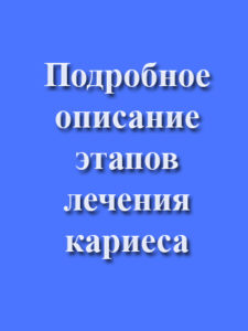 Скачать Подробное описание этапов лечения кариеса