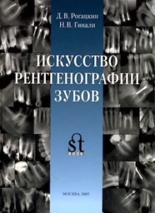 Скачать Искусство рентгенографии зубов - Рогацкин Д.В., Гинали Н.В. + Коллекция рентгенограмм