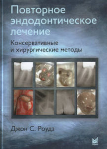 Скачать Повторное эндодонтическое лечение: консервативные и хирургические методы - Джон Роудз