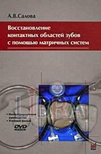 Скачать Восстановление контактных областей зубов с помощью матричных систем - Салова