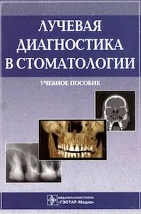 Скачать Лучевая диагностика в стоматологии - Васильев, Воробьев, Серова