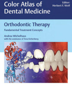 Download Orthodontic Therapy Fundamental treatment concepts Wichelhaus