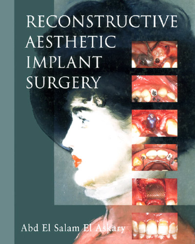 download Reconstructive aesthetic implant surgery Abd El Salam El Askary